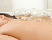 Cupping therapy