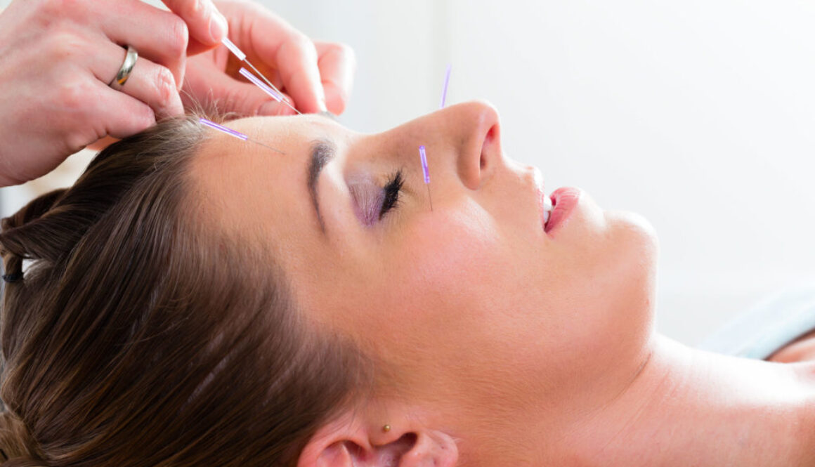 Discover facial acupuncture at the best day spa in Chicago