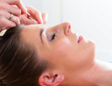 Discover facial acupuncture at the best day spa in Chicago